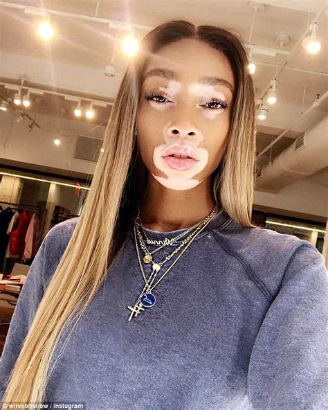 Winnie Harlow Shows Off Her Washboard Abs In Double Denim As She Enjoys