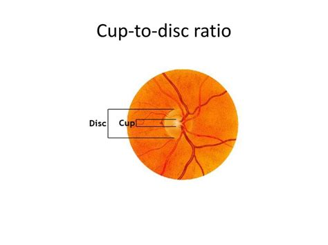 PPT - Ophthalmologic Evaluation PowerPoint Presentation, free download