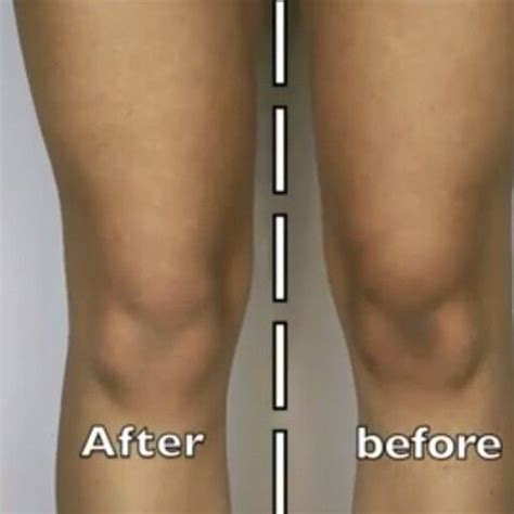 Beautyhack How To Lighten Dark Knees And Elbows With Baking Soda And