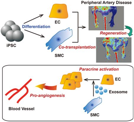An IPSC Based Cell Cotransplantation Therapy For Critical Limb Ischemia Stem Cells Portal