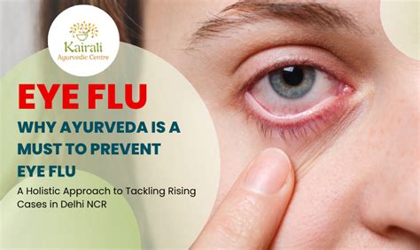 Why Ayurveda Is A Must To Prevent Eye Flu A Holistic Approach To