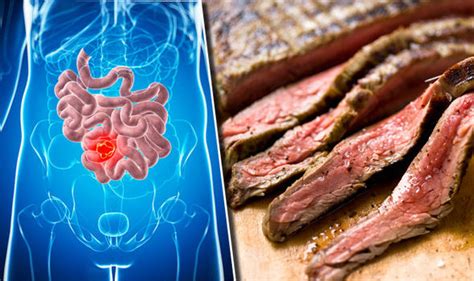 The signs and symptoms noted above can commonly be a result of another condition or simply a change in lifestyle. Bowel cancer warning: THIS factor may fuel disease - it ...