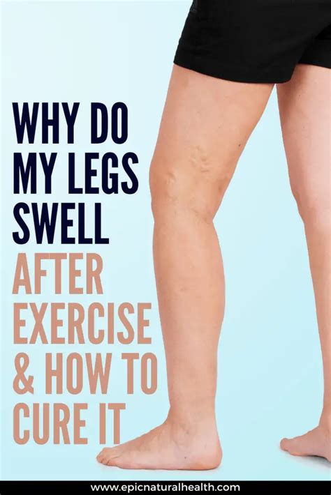 Why Do My Legs Swell Up After Exercise How To Cure Leg Swelling Pain