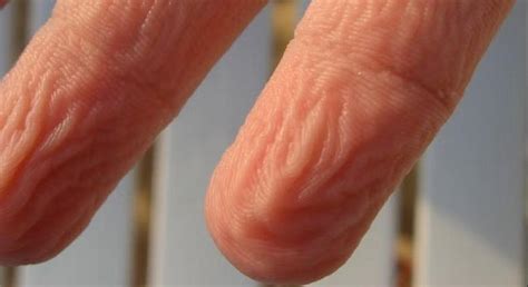 Ever Wondered Why Your Fingers Get Wrinkled When Wet Here S The