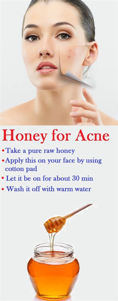 How To Apply Honey To Treat Acne Healthy Beauty Health And Beauty