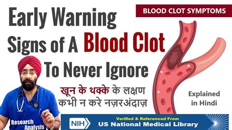 Never Ignore These Symptoms Early Warning Signs Of A Blood Clot Dr