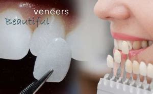 Check spelling or type a new query. Cheaper Alternatives to Dental Veneers