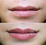 Photos of Permanent Lip Makeup Near Me