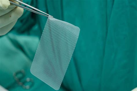 Hernia Mesh How A Patch Can Torment Your Body After Surgery Safety Watch