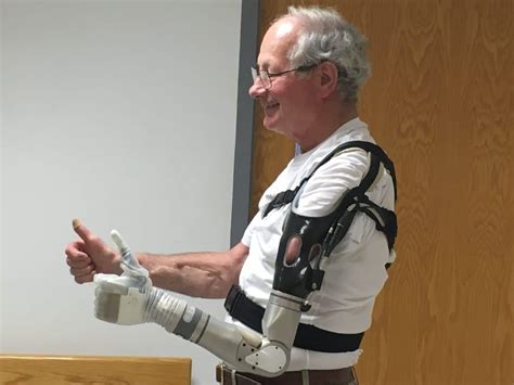 Luke Arm Is A Prosthetic Arm That Can Sense Every Touch