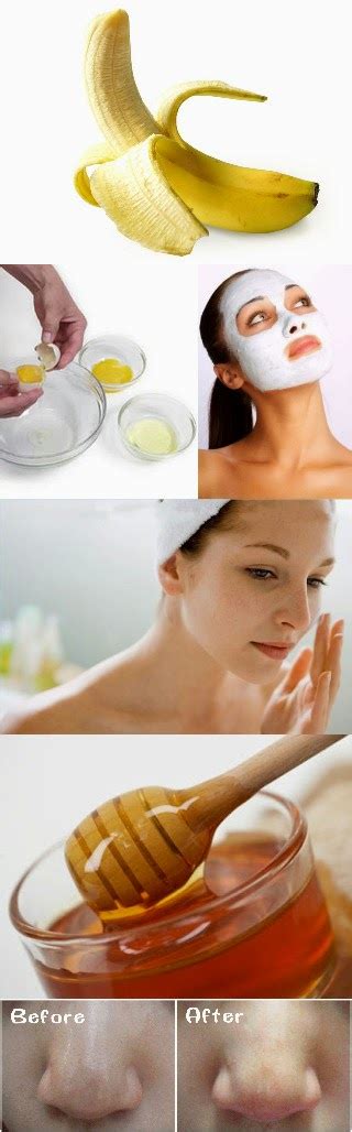 3 Most Effective Natural Remedies To Remove Blackheads Especially On