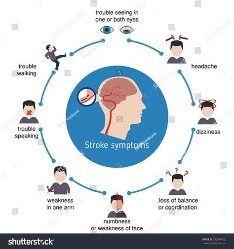 Infographics Stroke Stroke Symptoms Vector Illustration Vector Có Sẵn
