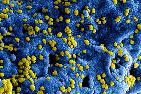 Das bild zeigt, wie das coronavirus medizinisches personal an die grenzen bringt. Mysteriöse Lungenerkrankungen: Neues Coronavirus in China ...