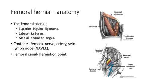 Femoral Hernia Vs Swollen Lymph Node Images And Photos Finder