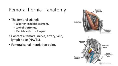 Femoral Hernia Diagram