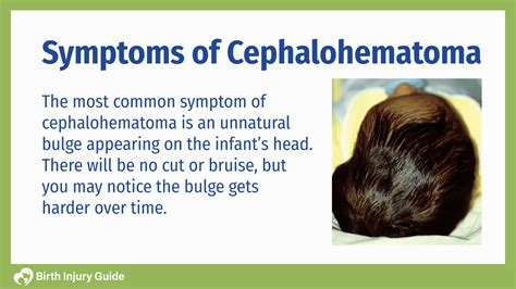 Infant Cephalohematoma Causes Treatment And Prevention