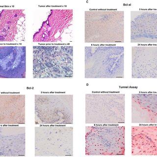 Histology And Immunohistochemistry Examination Histopathology