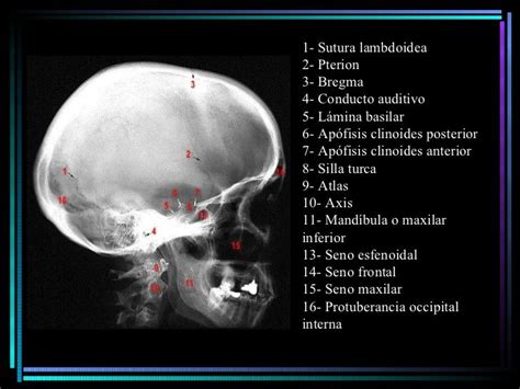 radiografia lateral de cabeza Radiografia de craneo Estudiante de radiología Imagenes de medicos