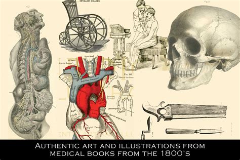 Vintage Medical Illustrations On Yellow Images Creative Store