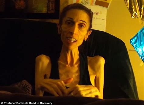 Anorexic Actress Rachael Farrokh Thanks The Public For Fundraising K Daily Mail Online