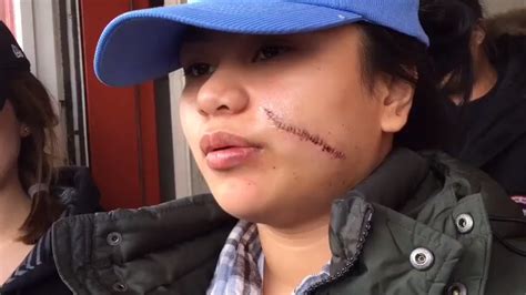20 year old woman robbed slashed in face while walking home in the bronx abc7 new york