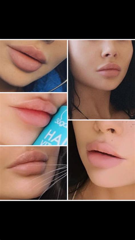 Pin By Nathalie Chabrut On Lips Lip Injections Lip Fillers Lip
