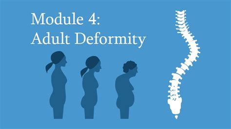 Adult Spinal Deformity Online Spine Course EccElearning