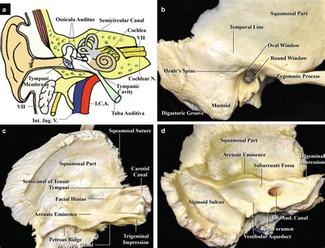 The Temporal Bone Basic Anatomy And Approaches To Internal Auditory