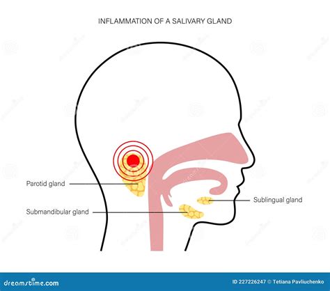Salivary Gland Concept Stock Vector Illustration Of Oral 227226247