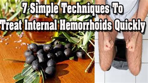 7 Simple Techniques To Treat Internal Hemorrhoids Quickly Activebeat