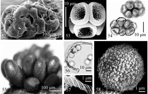 Reticularia Sp Le 237000 52 Sporocarp By Sem 53 Spore Clusters