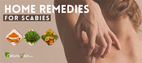 6 Home Remedies For Scabies Herbal Treatments That Work