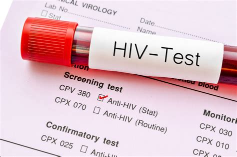 What You Need To Know Before Getting An Hiv Test In Singapore
