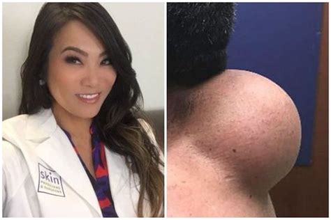 dr pimple popper is getting her own tv show and the trailer already has us squirming