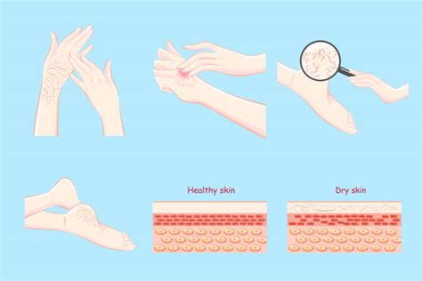 1700 Itchy Skin Illustrations Royalty Free Vector Graphics And Clip