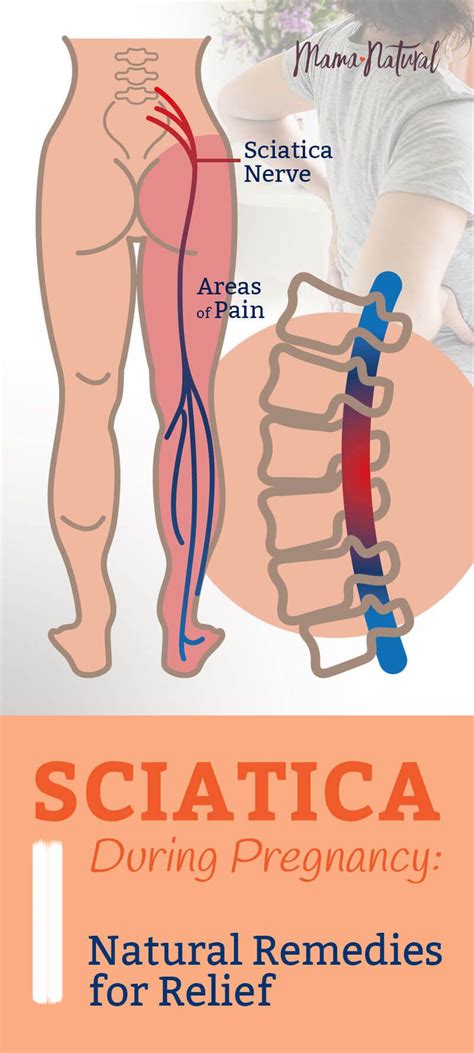 How To Help Sciatic Nerve Pain In Back While Pregnant