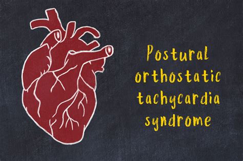 Postural Orthostatic Tachycardia Syndrome Pots Gi For Kids
