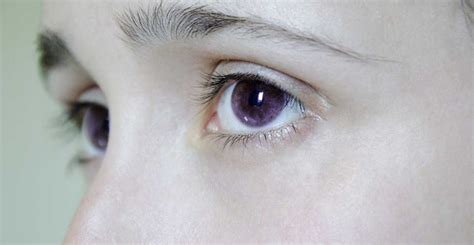 A Collection Of People With Purple Eyes And What Causes Them With