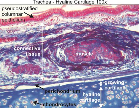 Trachea Slide Labeled