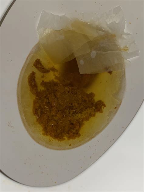 I’ve been having this time of poop for about 2 weeks now should I be