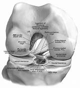 Exercise Program After Acl Surgery Pictures