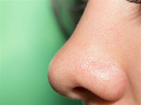 Cellulitis Symptoms Nose The Request Could Not Be Satisfied