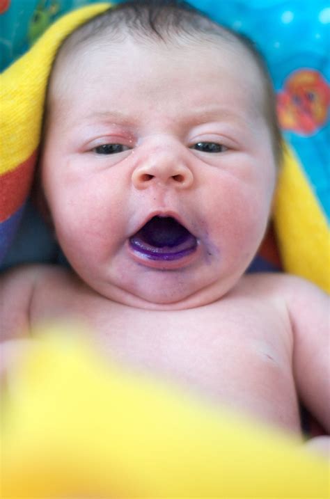 Gentian Violet Deep Purple Dye Kills Some Cancer Cells