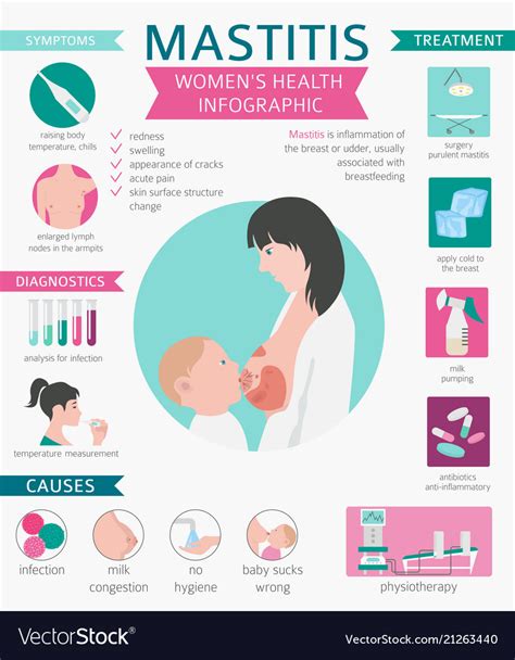 Mastitis Breastfeed Medical Infographic Royalty Free Vector