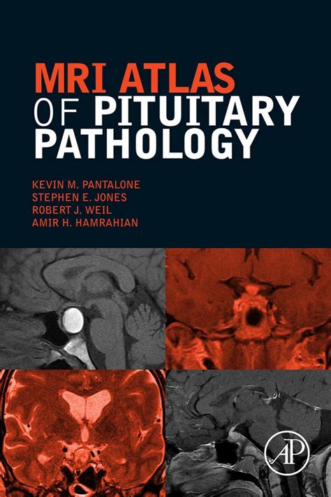 Mri Atlas Of Pituitary Pathology 1st Edition Pdf Free Download Direct