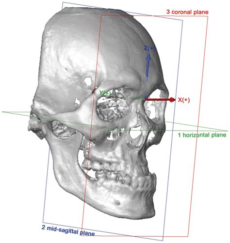 The 3d Coordinate System And Reference Planes Of The Head X Axis