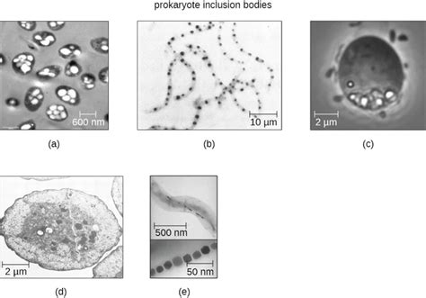 How To Tell If Its A Prokaryote Under A Microscope A Step By Step