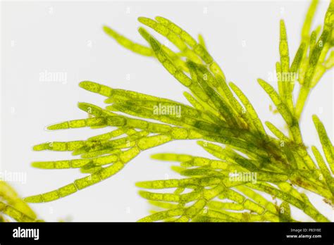 Microscopic View Of Green Algae Cladophora Brightfield Illumination