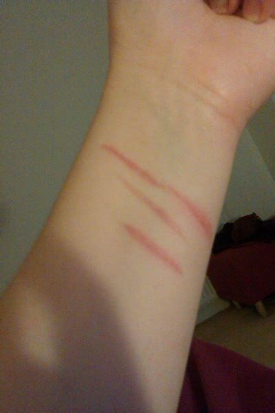 Do These Look Like Self Harm Scars Beautylish