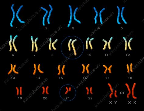 Philadelphia Chromosome Illustration Stock Image C0555373